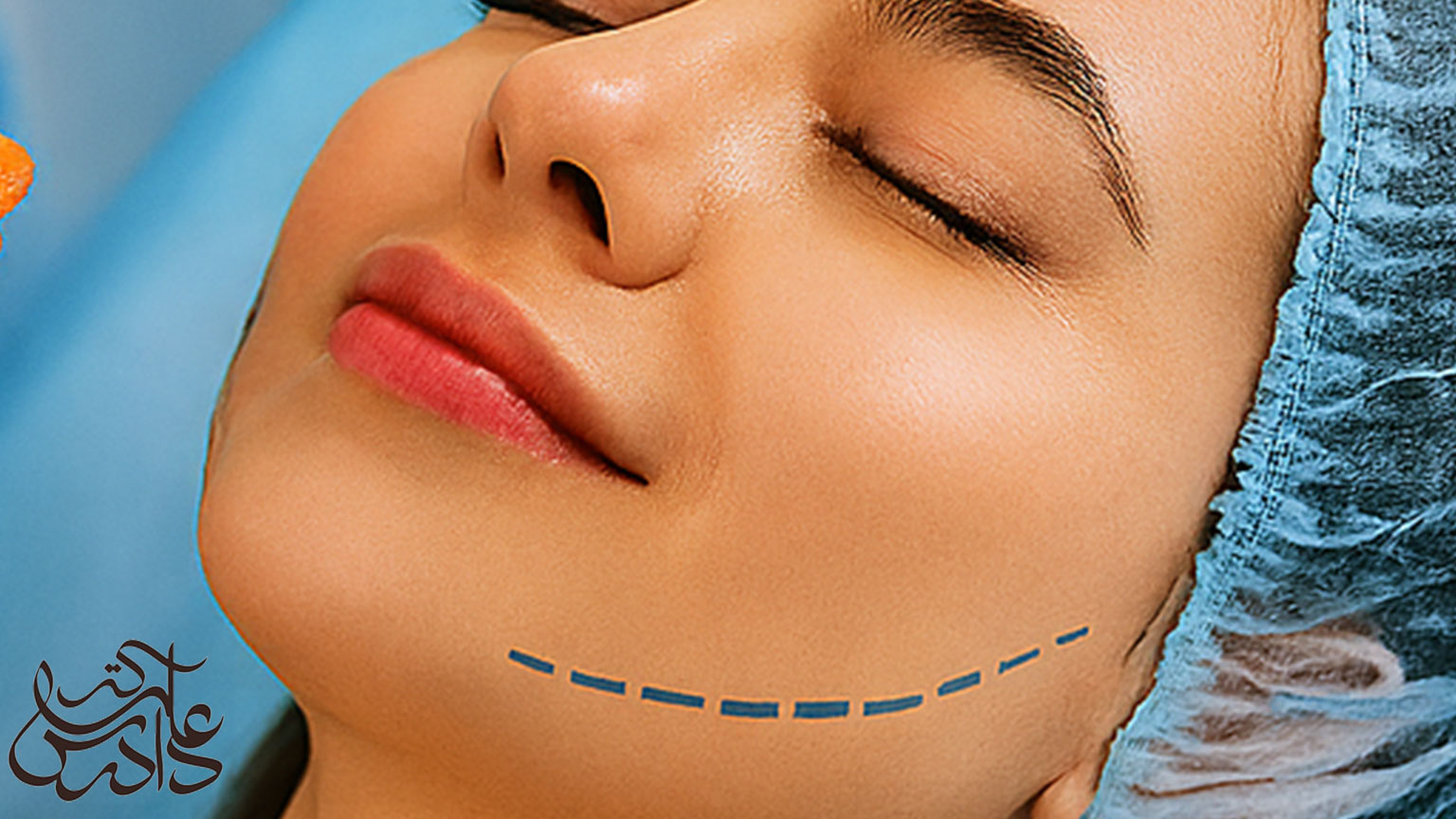 جراحی بوکال دکتر دادرس